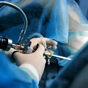 Hysteroscopy Systems