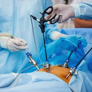 Laparoscopy Systems