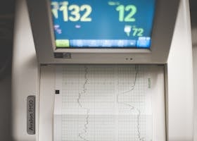 Electrocardiographs (ECG)