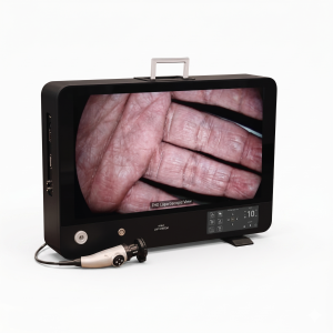 4-in-1 Laparoscopy System (Camera + Light Source + Monitor)